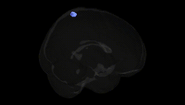 Full Brain Black