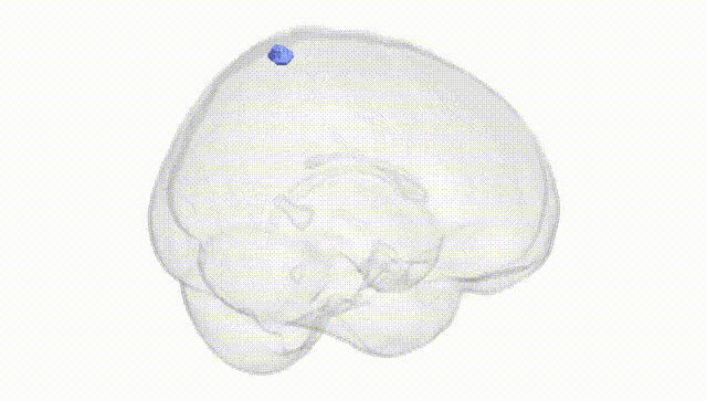Full Brain White