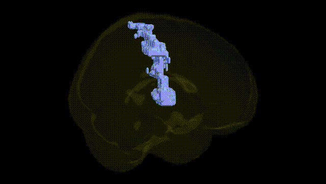 Full Brain Black