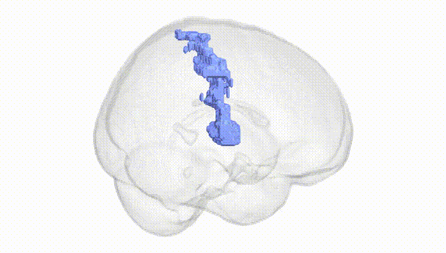 Full Brain White