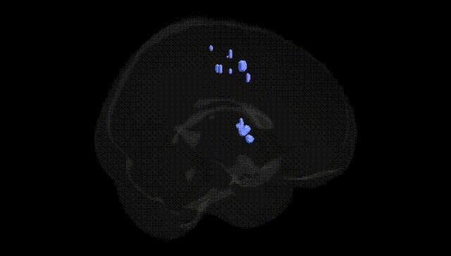 Full Brain Black