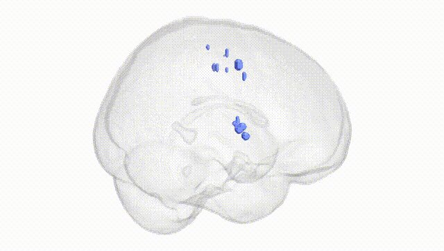 Full Brain White
