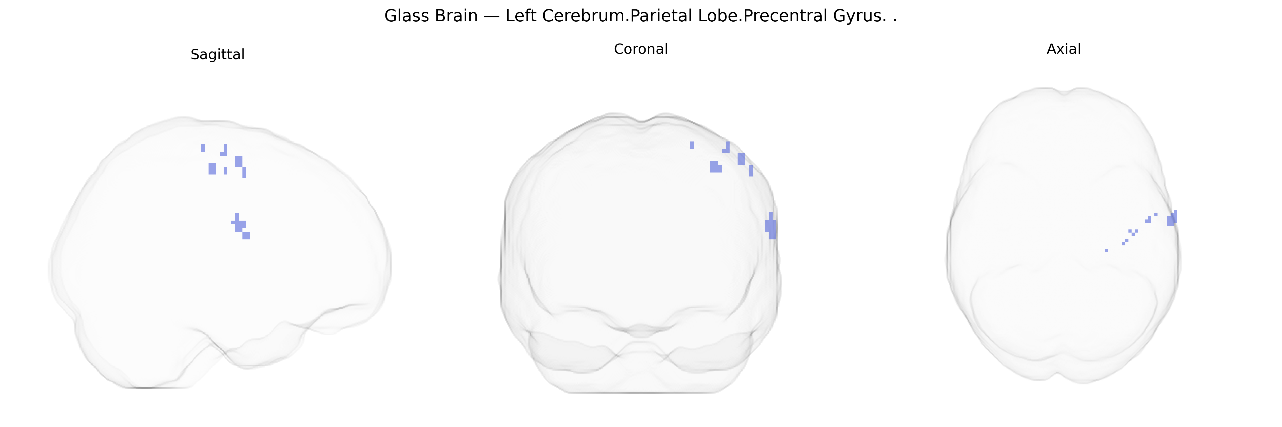 Triplanar Ghost Brain