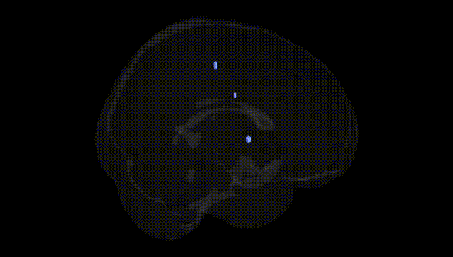 Full Brain Black