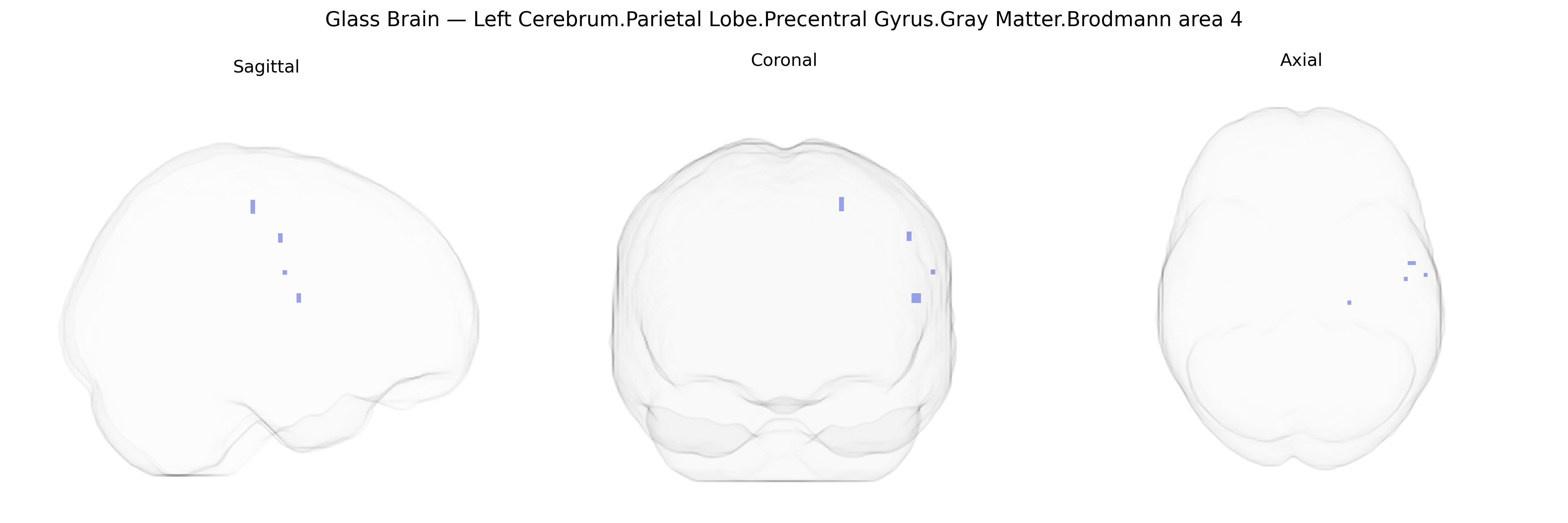 Triplanar Ghost Brain