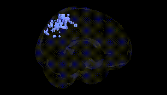 Full Brain Black