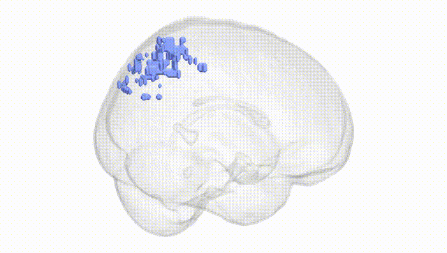 Full Brain White