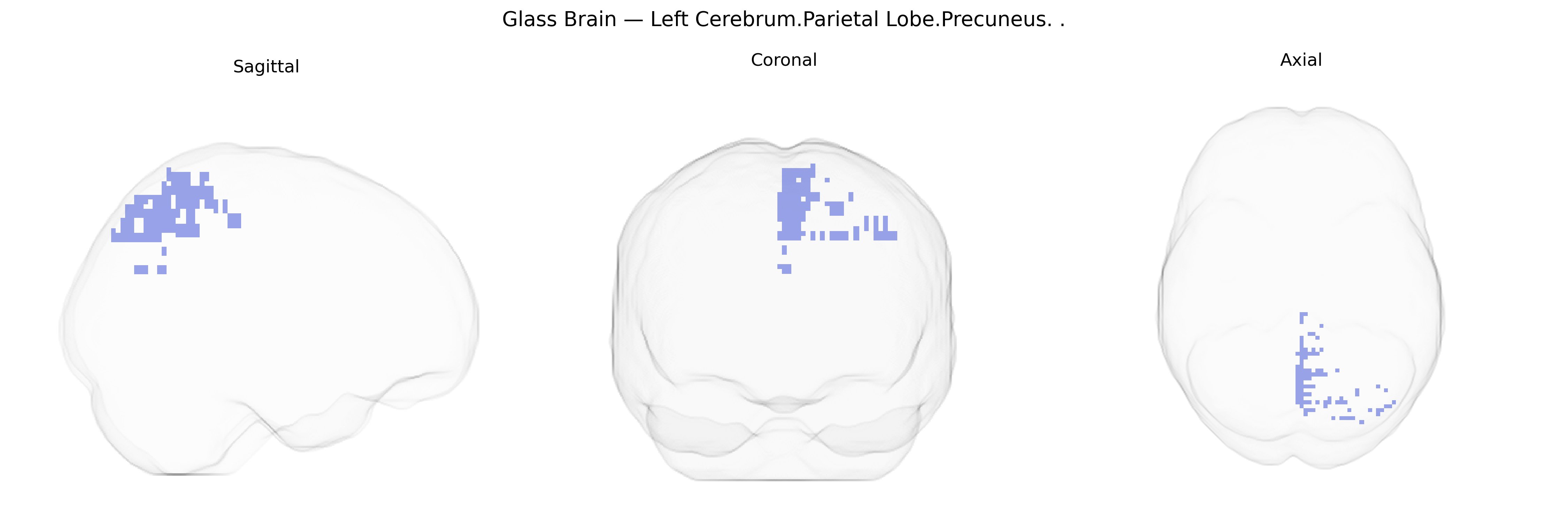 Triplanar Ghost Brain