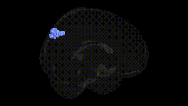 Full Brain Black