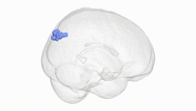 Full Brain White