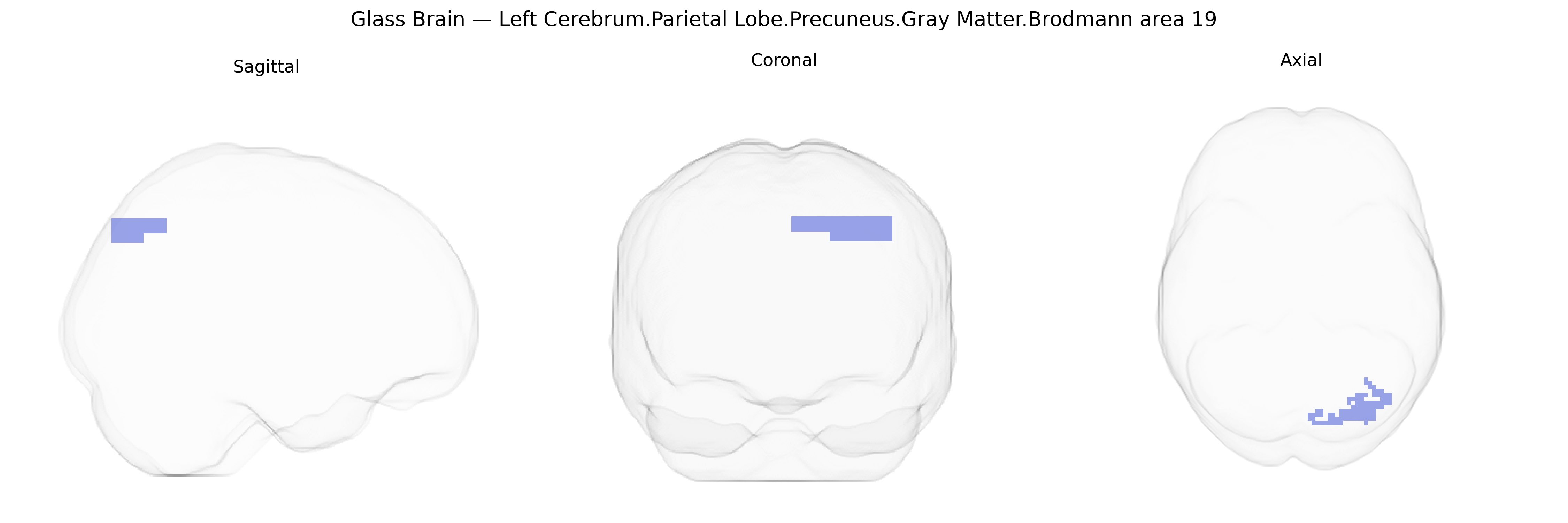 Triplanar Ghost Brain
