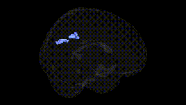 Full Brain Black