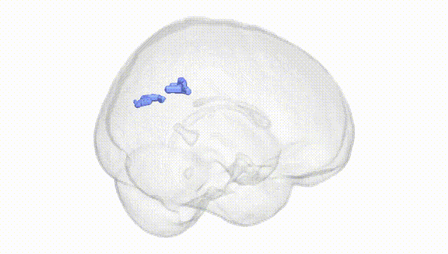 Full Brain White