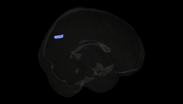 Full Brain Black