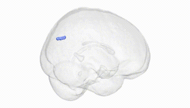 Full Brain White
