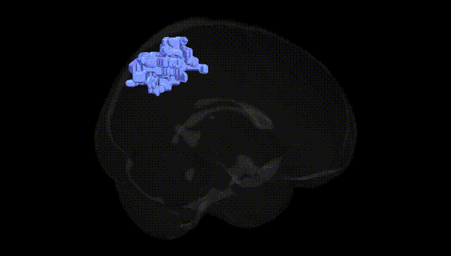 Full Brain Black