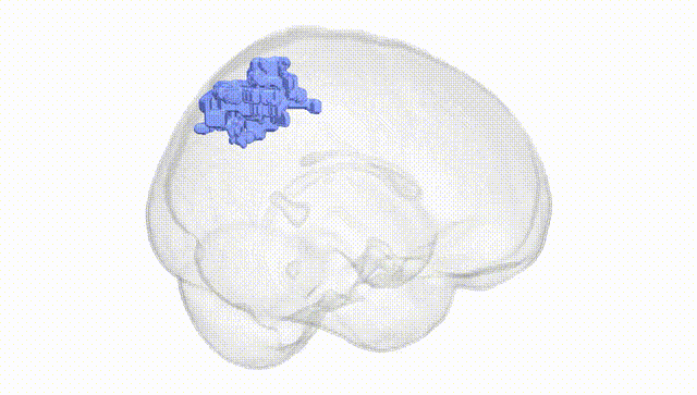 Full Brain White