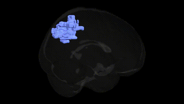 Full Brain Black