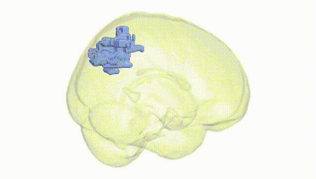 Full Brain White