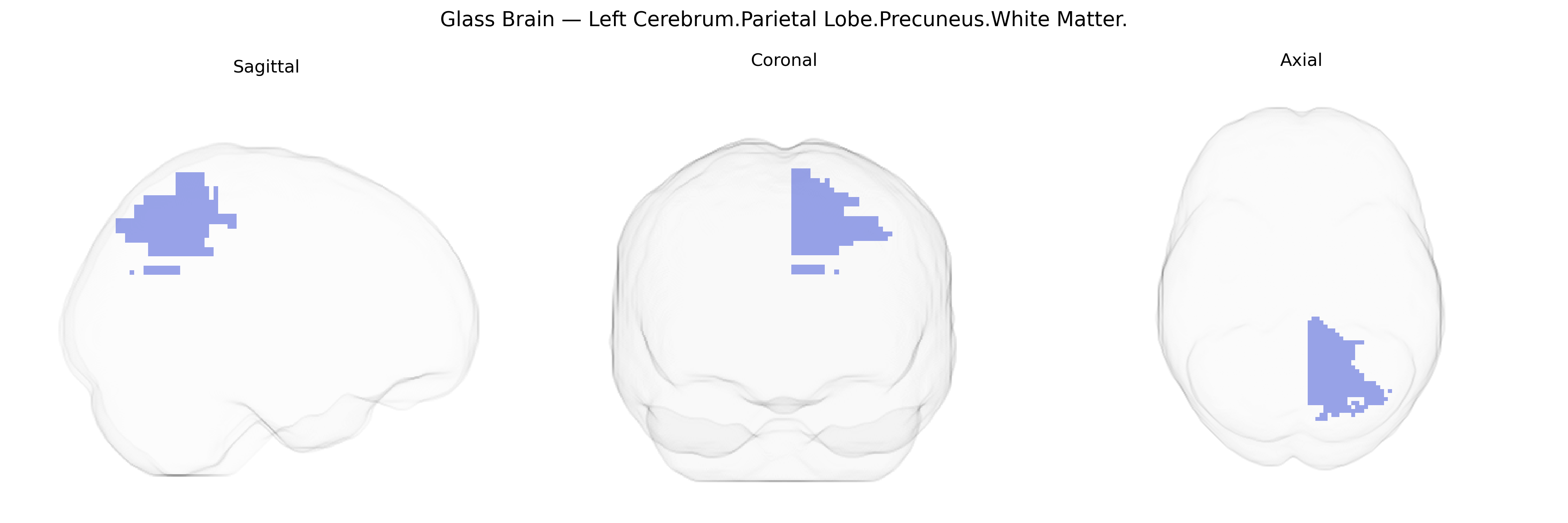 Triplanar Ghost Brain