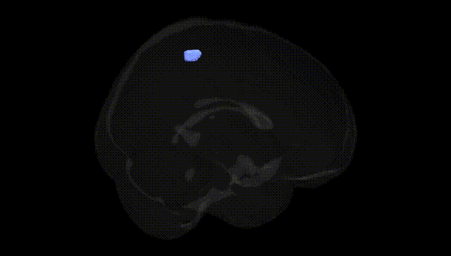 Full Brain Black