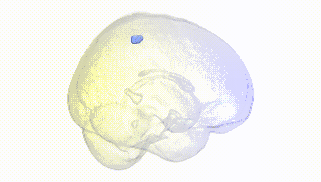 Full Brain White