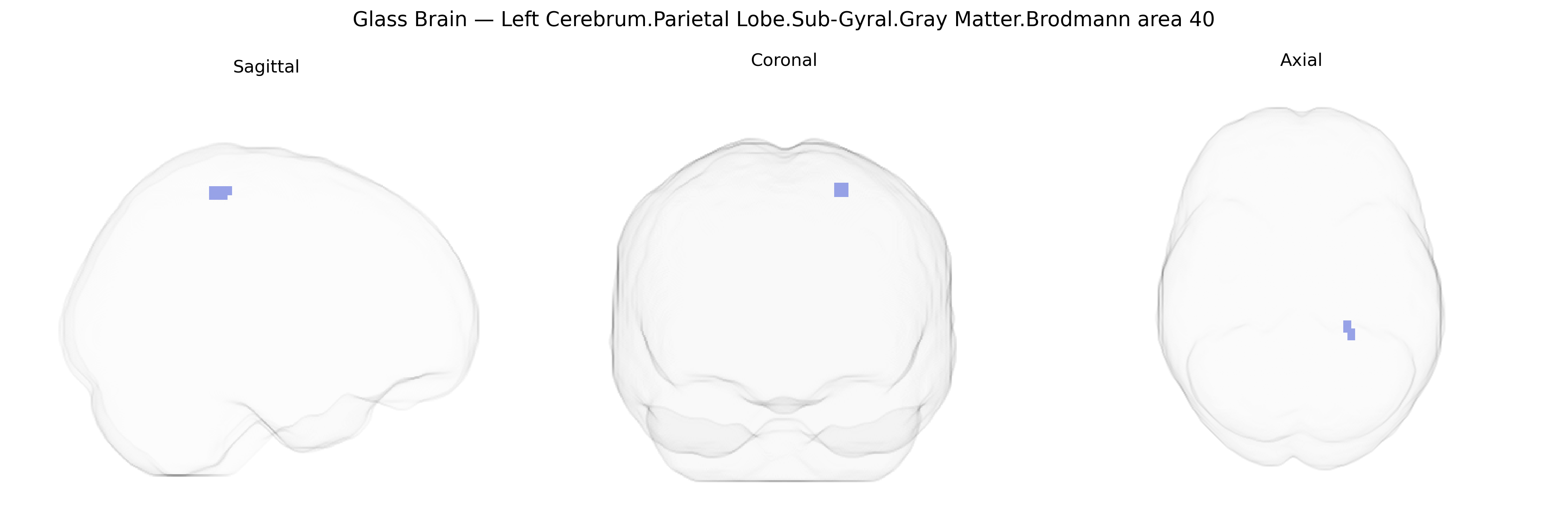 Triplanar Ghost Brain