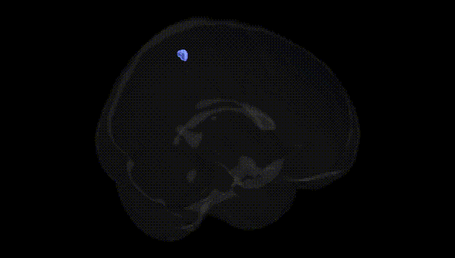 Full Brain Black