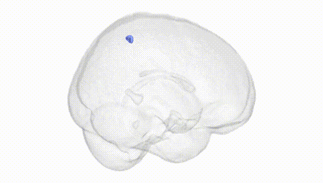 Full Brain White