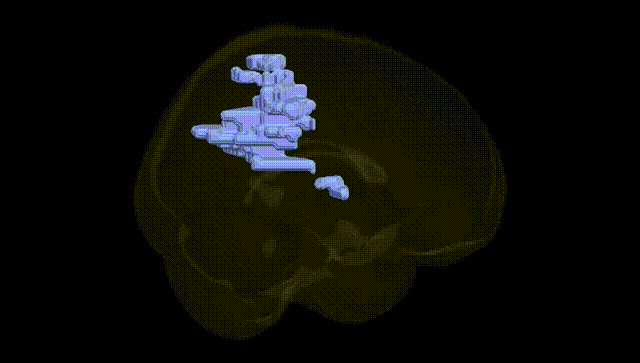 Full Brain Black