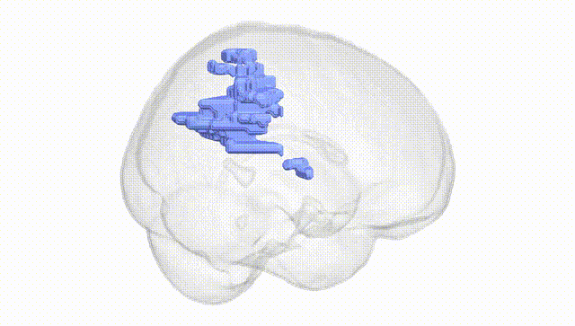 Full Brain White