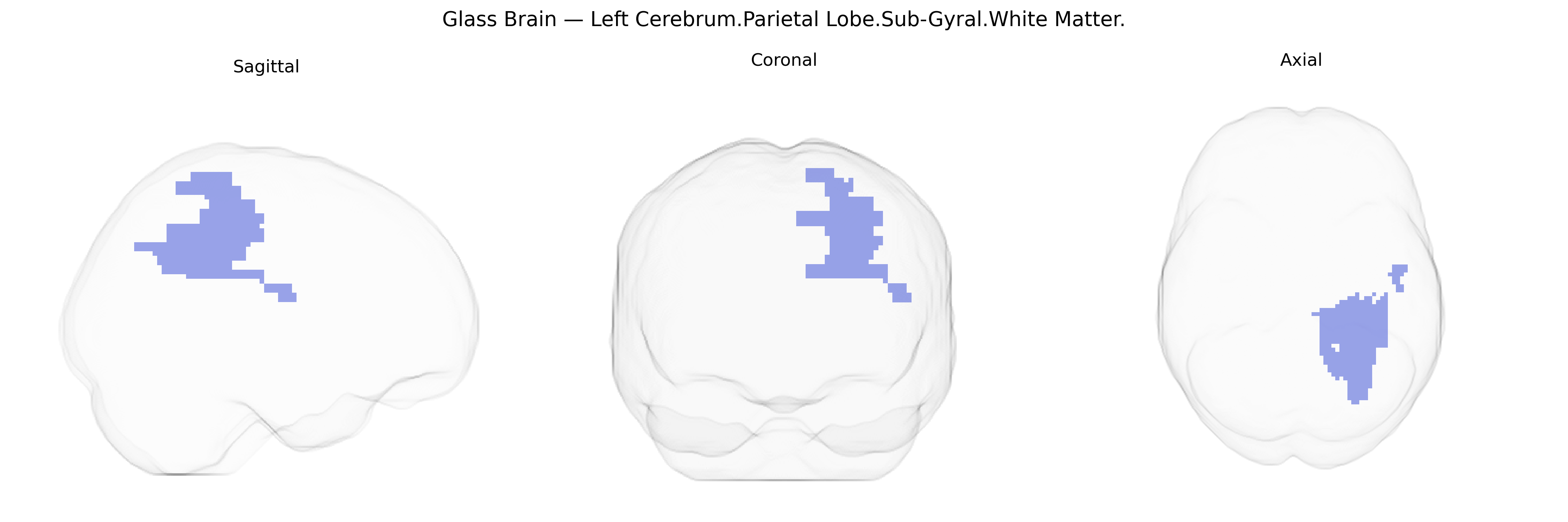 Triplanar Ghost Brain