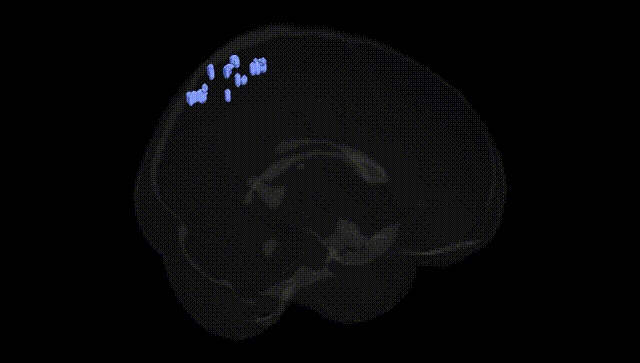 Full Brain Black