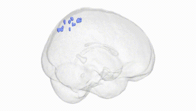 Full Brain White