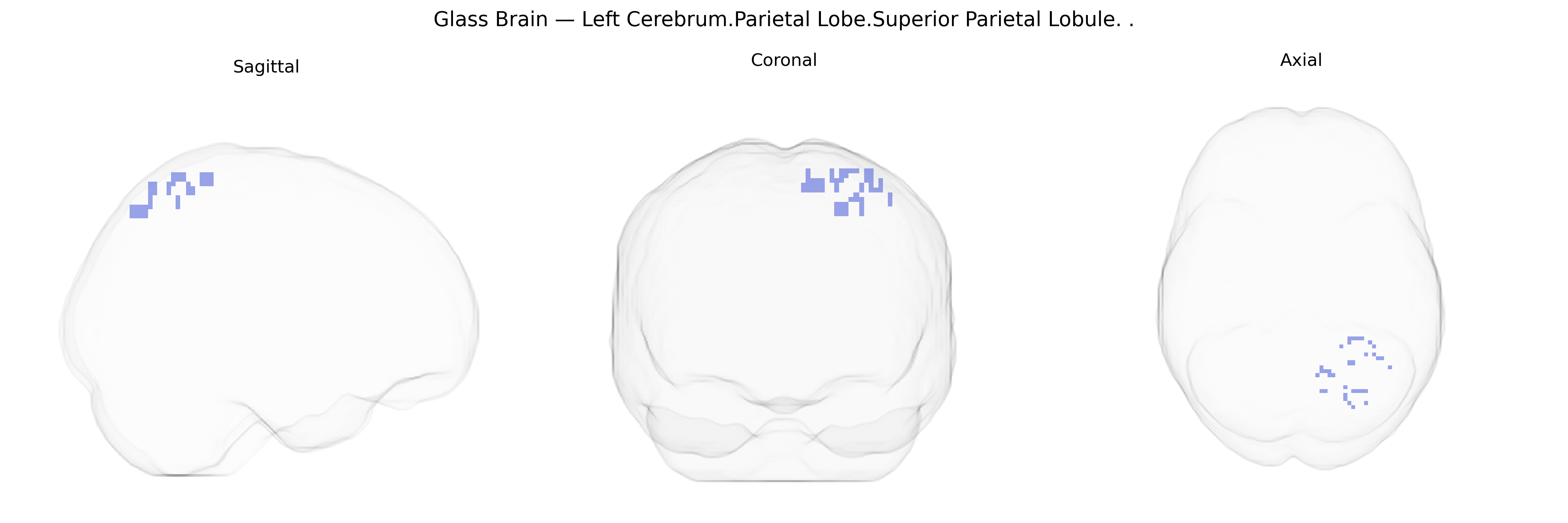 Triplanar Ghost Brain