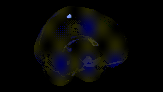Full Brain Black