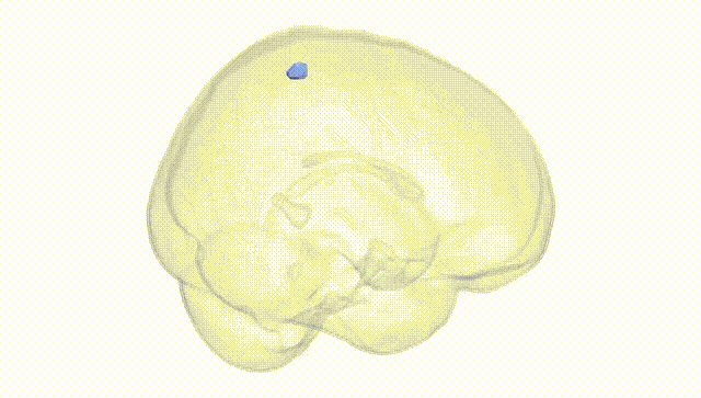 Full Brain White
