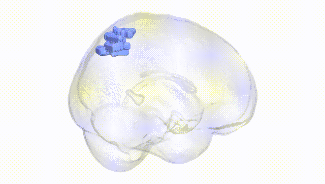 Full Brain White