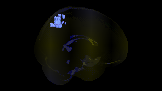 Full Brain Black