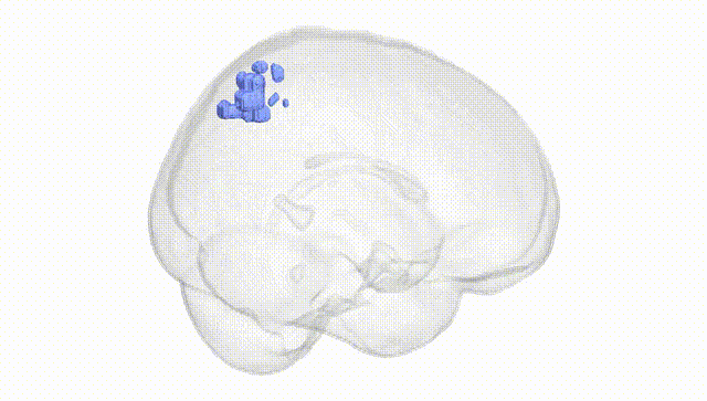 Full Brain White