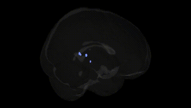 Full Brain Black