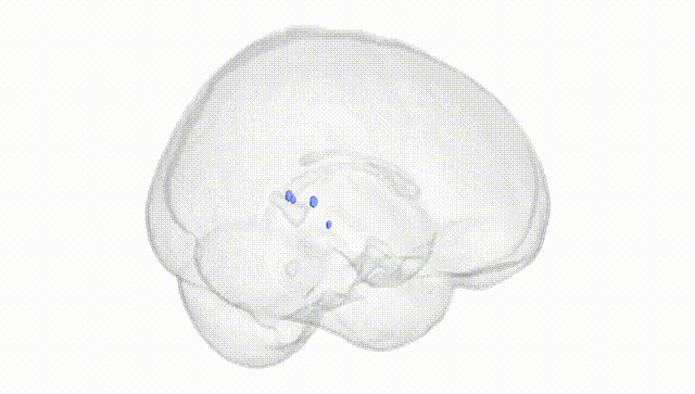 Full Brain White