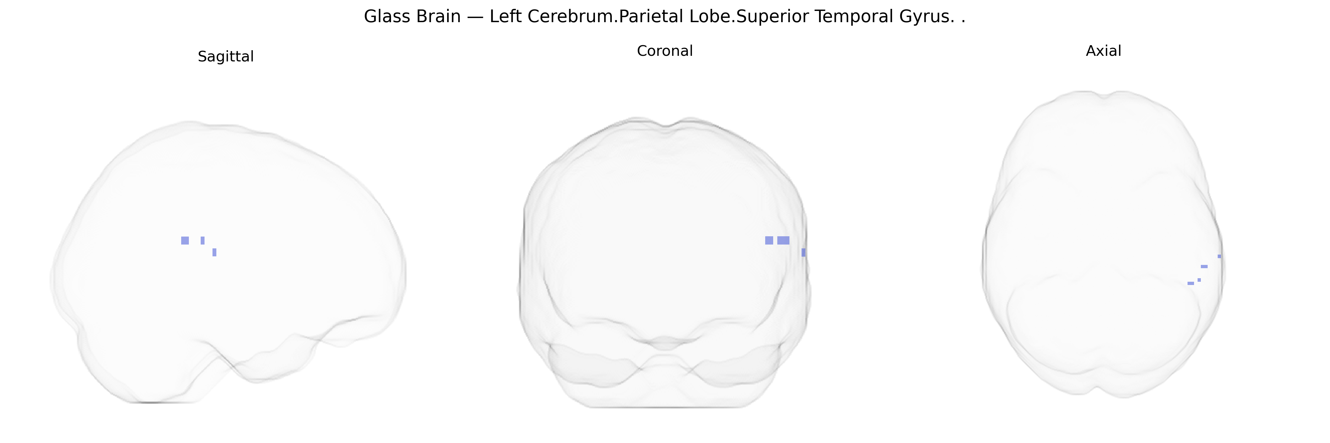 Triplanar Ghost Brain