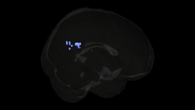 Full Brain Black