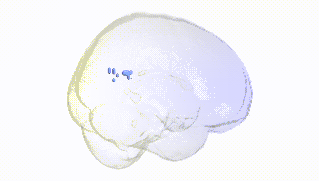 Full Brain White