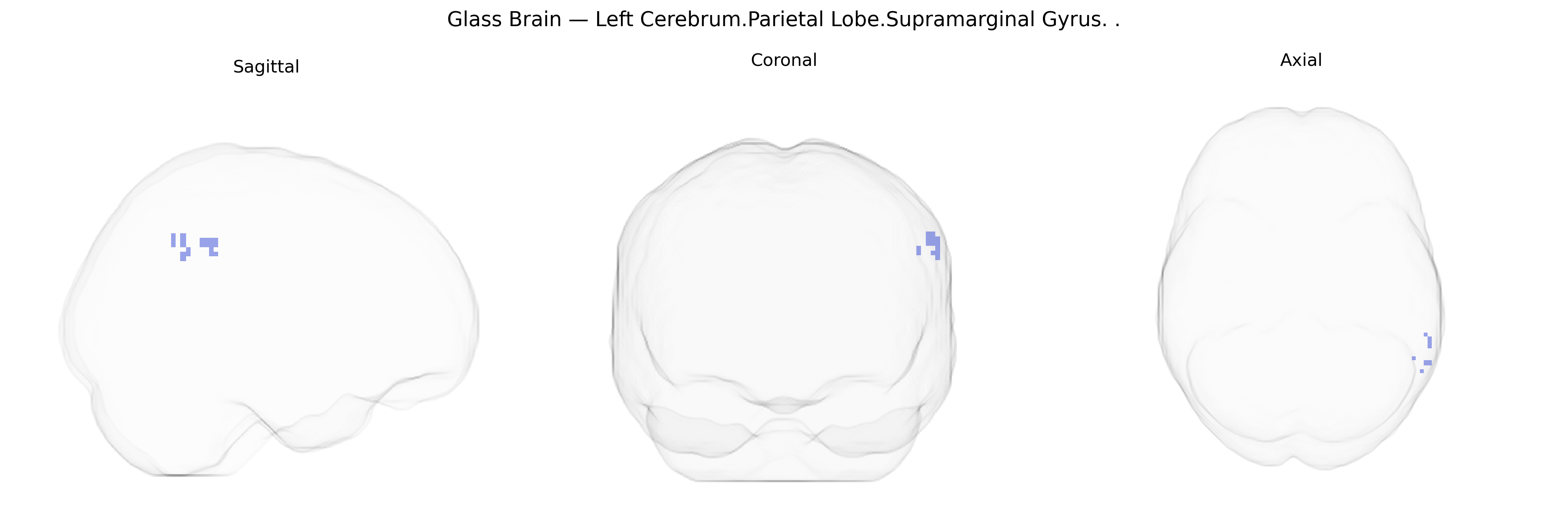 Triplanar Ghost Brain