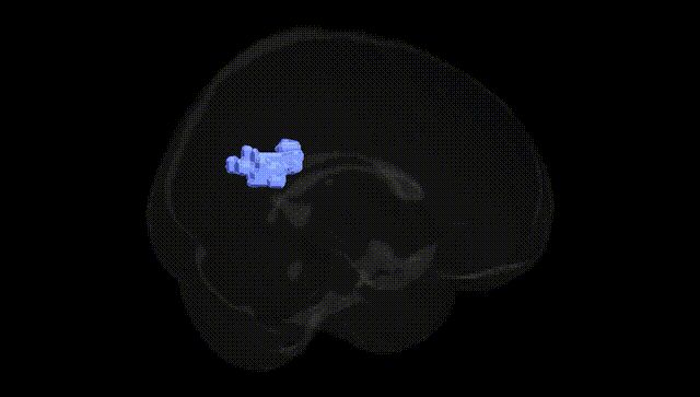 Full Brain Black