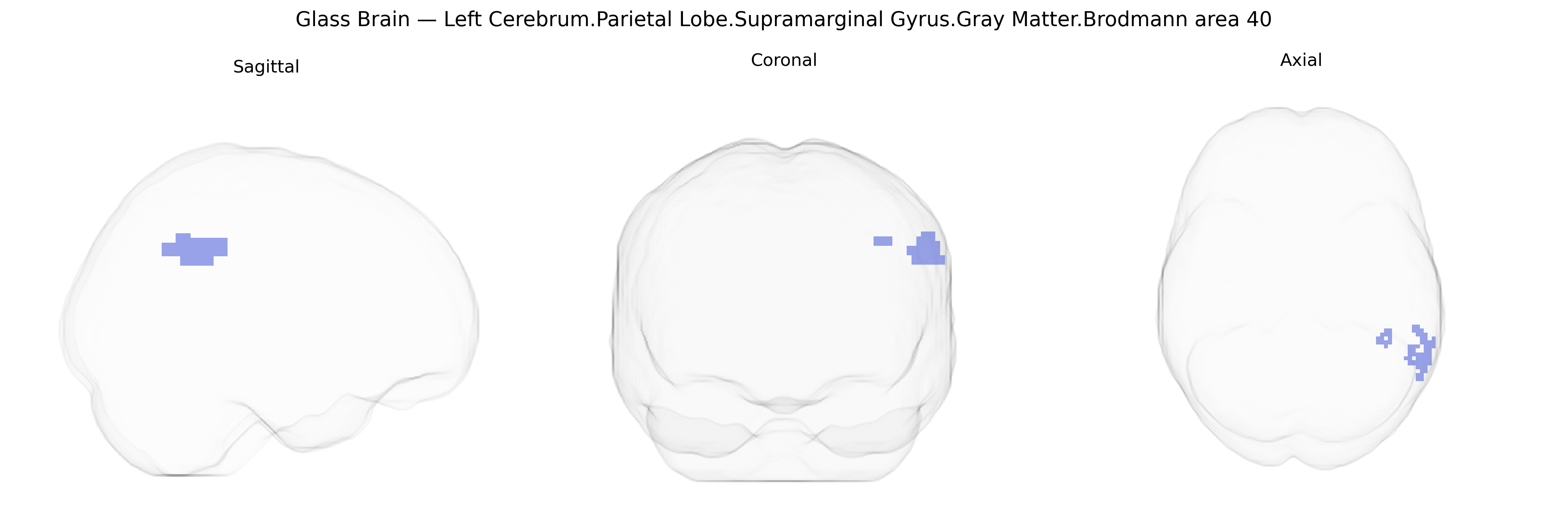 Triplanar Ghost Brain