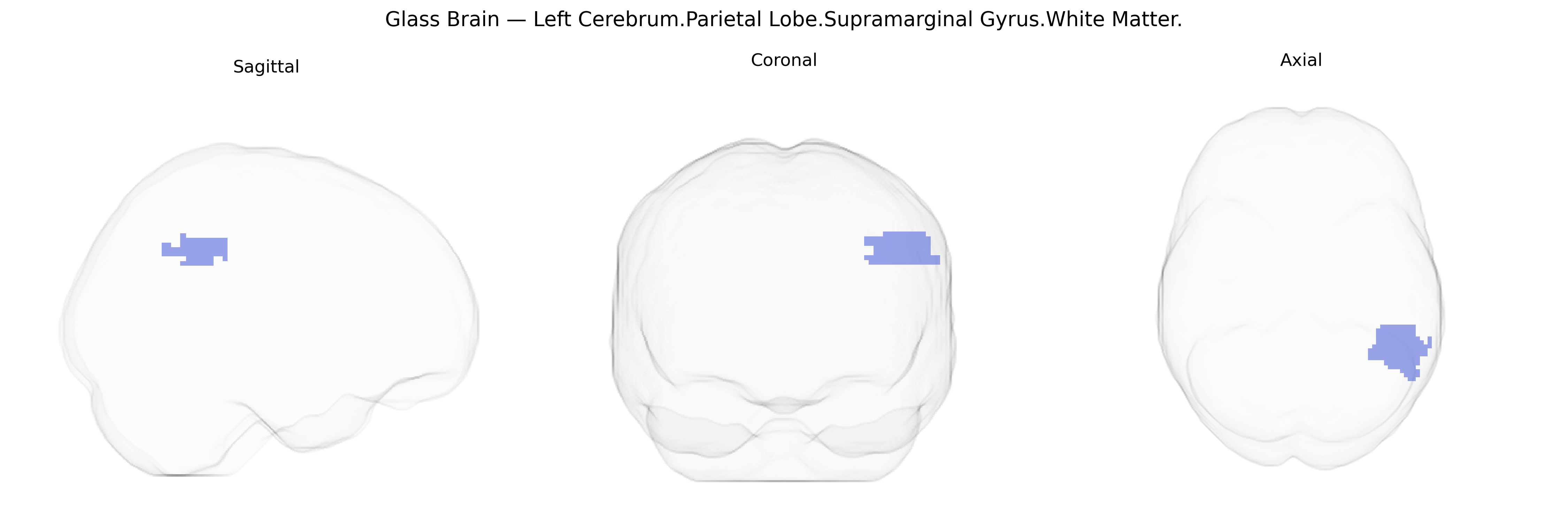 Triplanar Ghost Brain