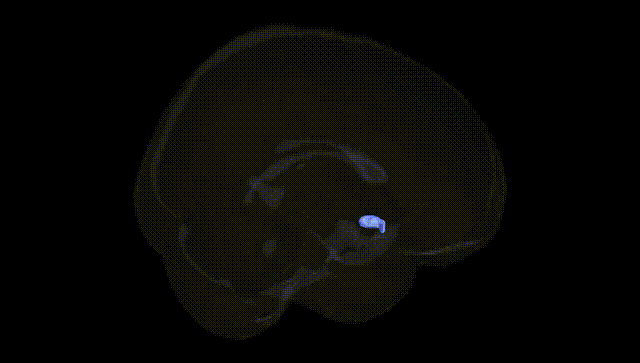 Full Brain Black